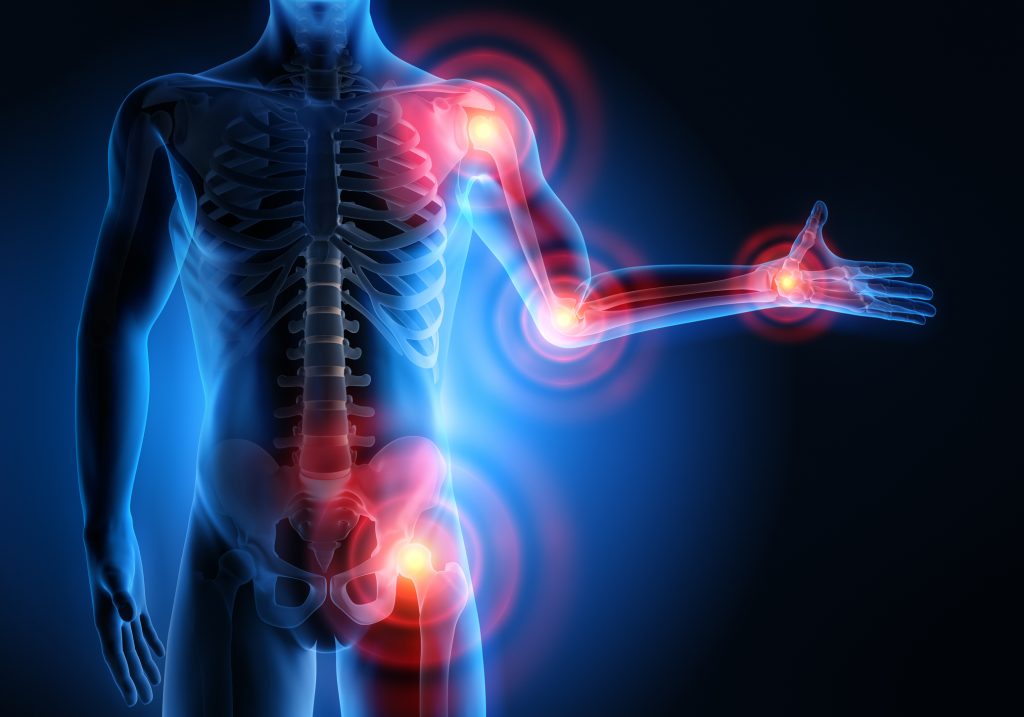3D Rendering - Severe pain in the joints - Rheumatism and arthrosis